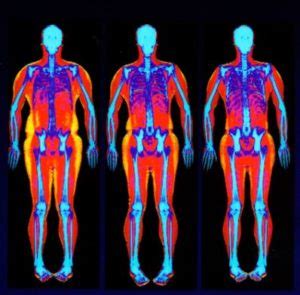 Where to Get a Body Composition Scan: A Detailed Exploration